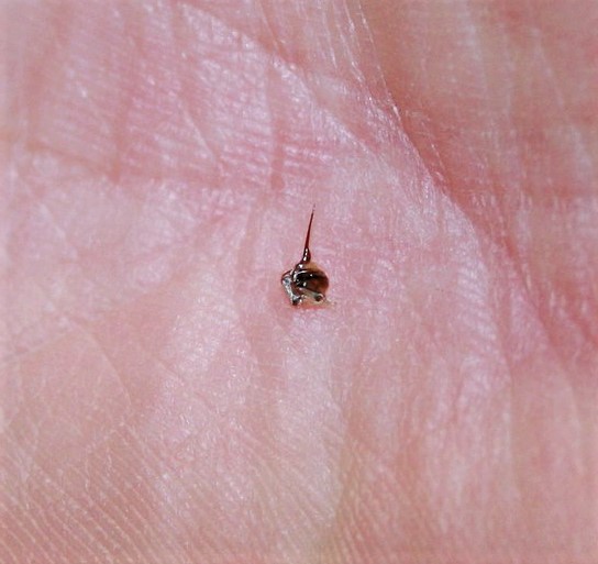 piqure d'abeille remede