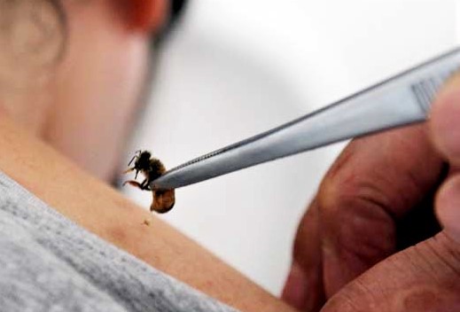 Apipuncture france
