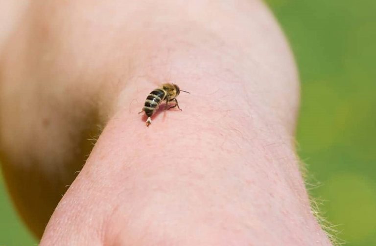 Que faire quand on se fait piquer par une abeille ?